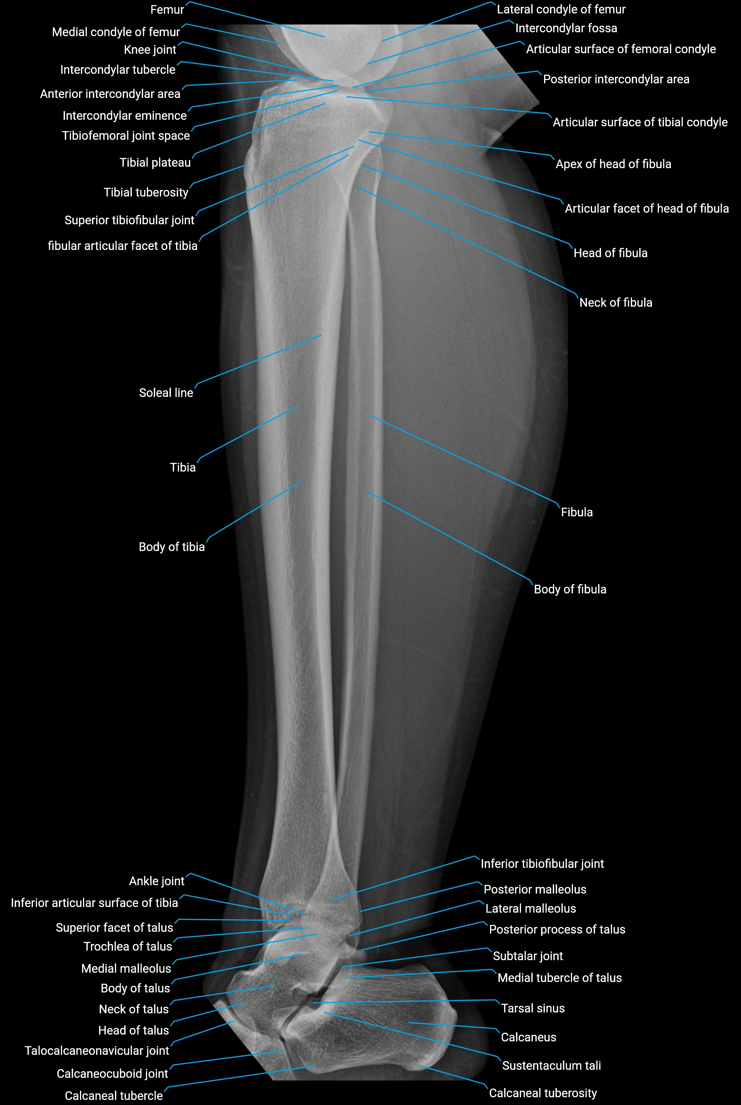 x ray  lower leg lat anatomy.webp